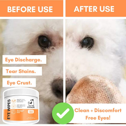 Eye Wipes