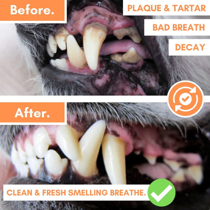 Dental Wipes